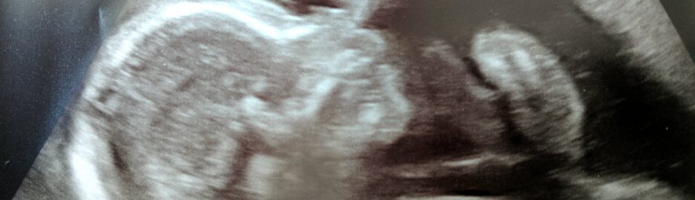 Ultrasound scan of Jake