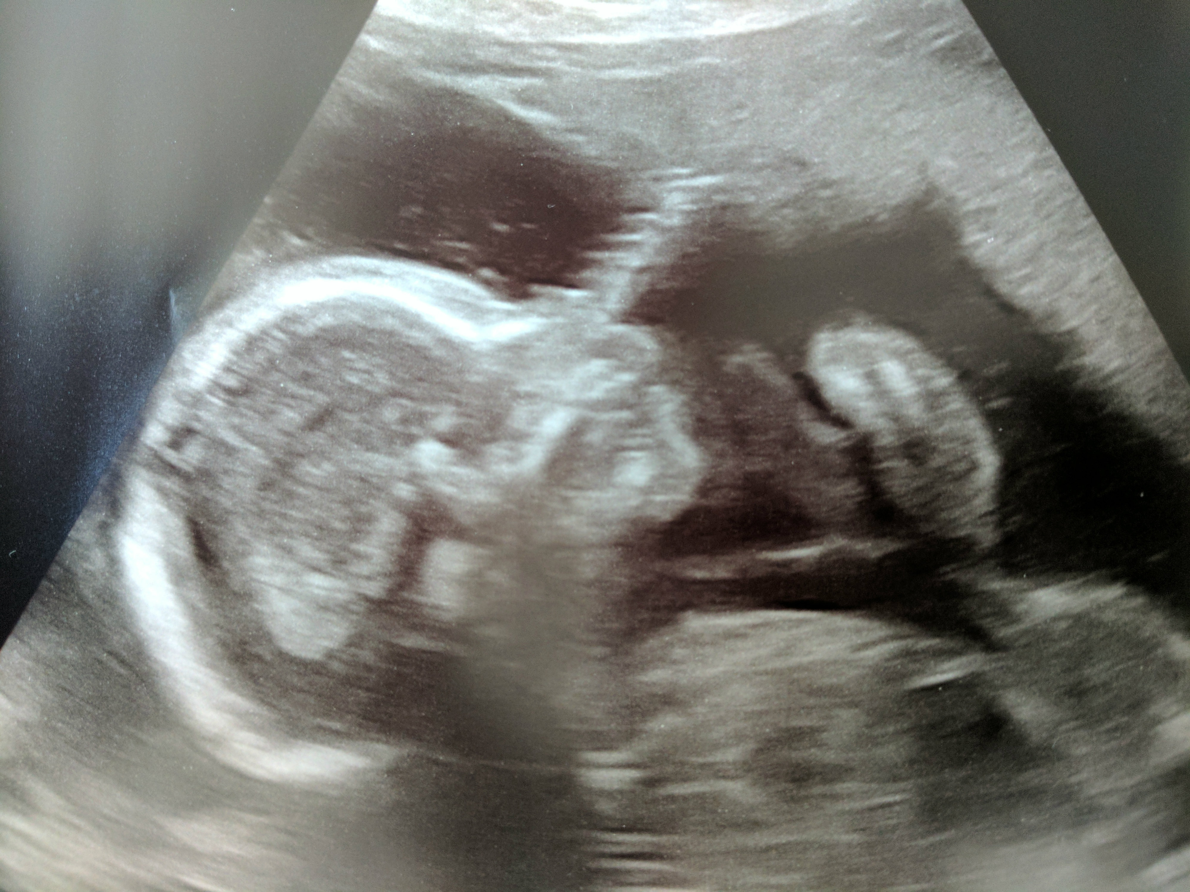 Ultrasound scan of Jake
